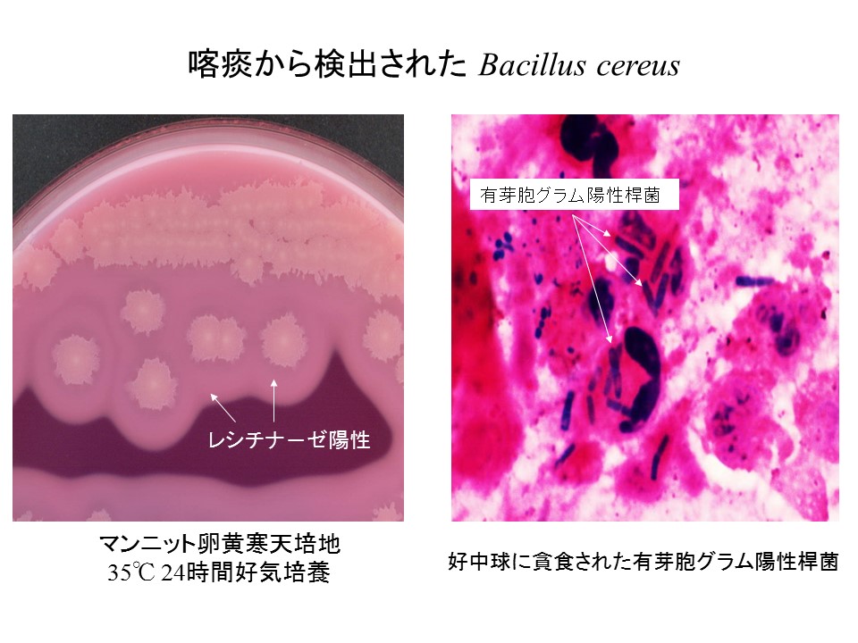 菌種別 Bacillus属 微生物検査 検査 診断matrix