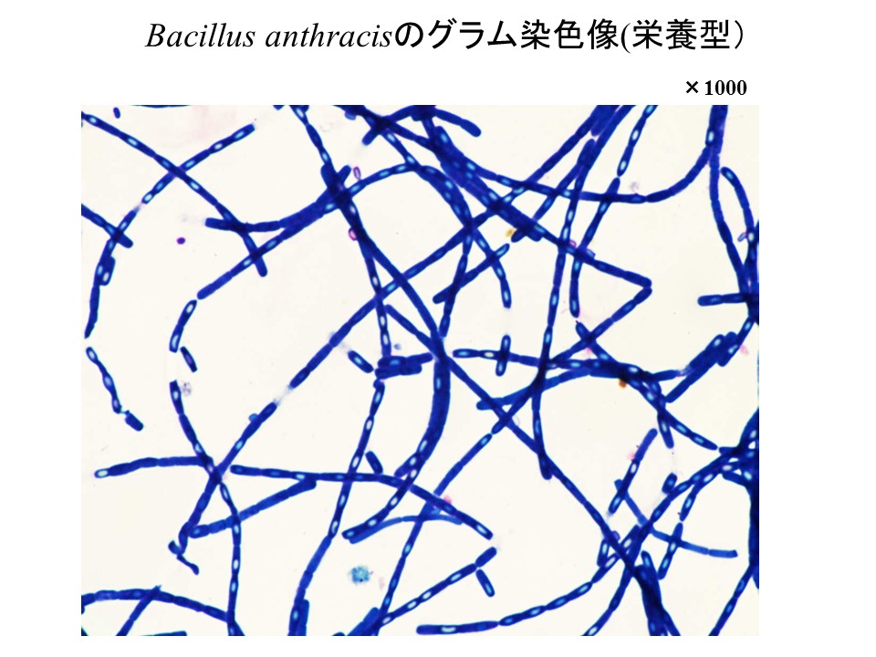 菌種別 Bacillus属 微生物検査 検査 診断matrix