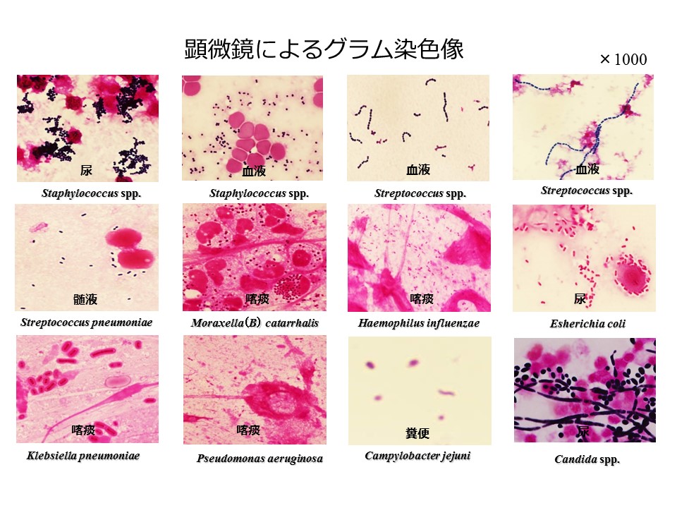 菌種別 Candida属 微生物検査 検査 診断matrix