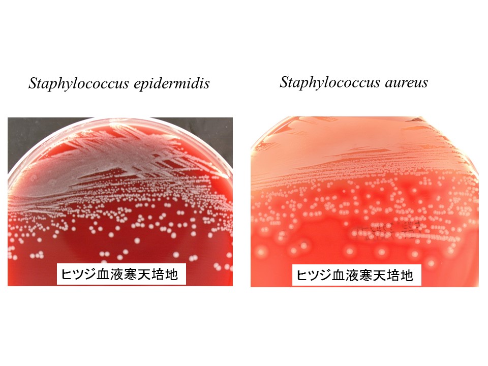 菌種別 Staphylococcus属 微生物検査 検査 診断matrix