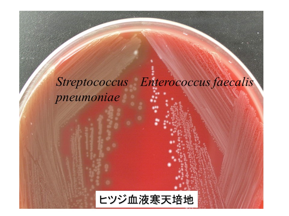 菌種別 Span Class P100italic Enterococcus Span 属 微生物検査 検査 診断matrix