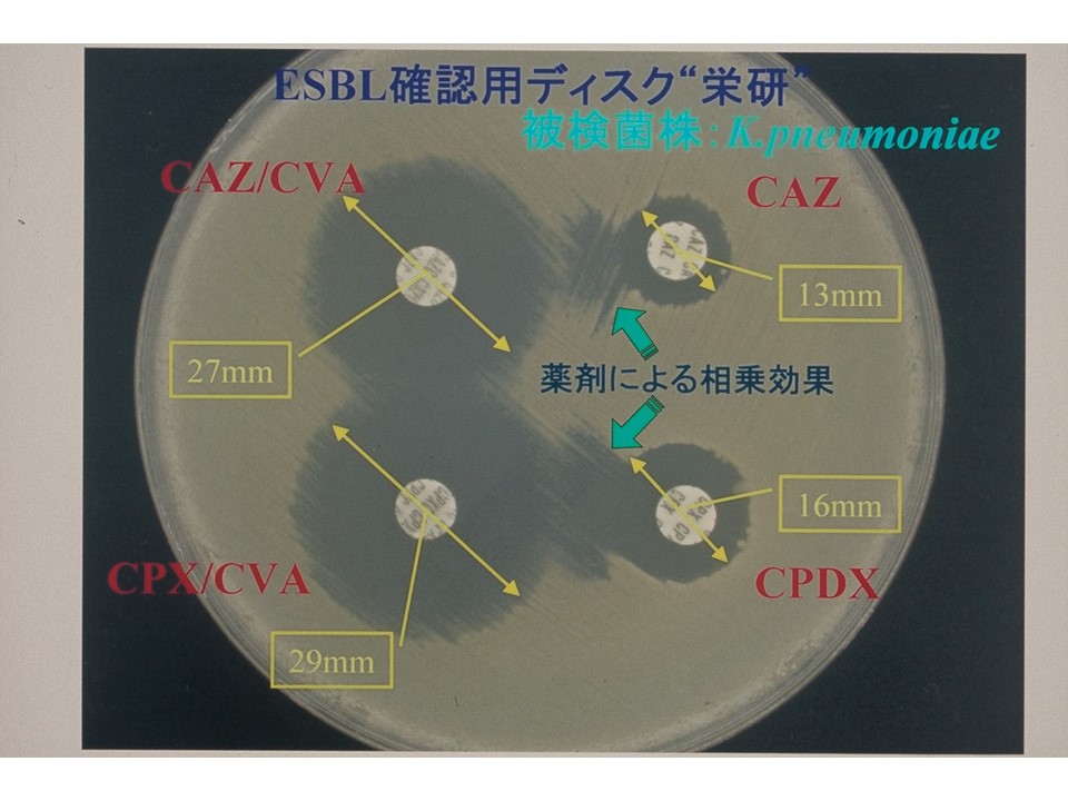 菌種別 Span Class P100italic Klebsiella Span 属 微生物検査 検査 診断matrix