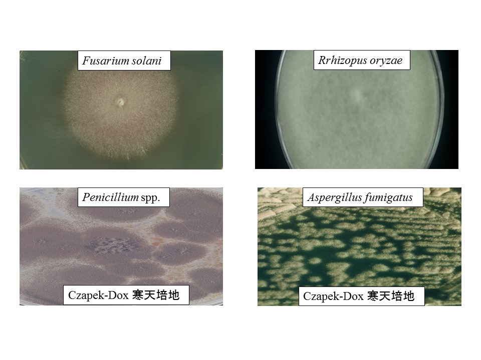 アスペルギルス分生子柄の図